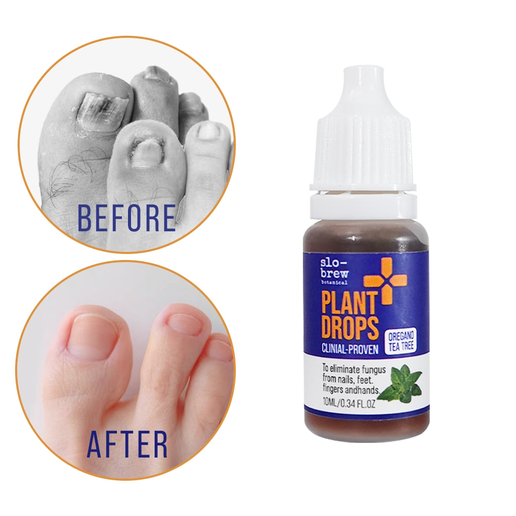 Slo-Brew Plant Drops – Fast-Acting Nail Repair Solution with Tea Tree & Oregano Oil